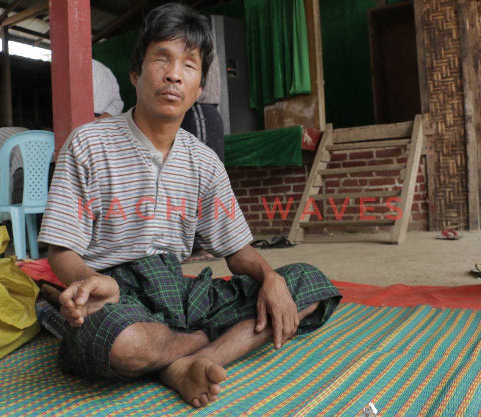 Sut Mai Yang IDP Blind